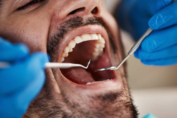 Best Dentist for Severe Toothache  in Depew, NY